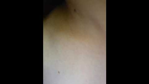 axel_20x